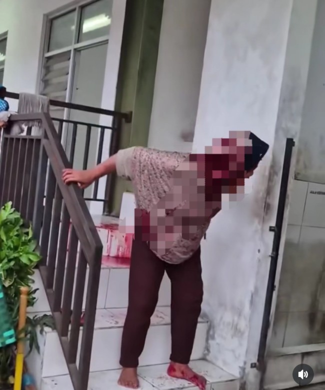 Viral Nenek Berdarah-darah Dipukuli karena Curi Bawang, Ini Reaksi Netizen