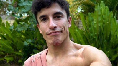 Marc Marquez Absen di MotoGP Australia dan Malaysia, Fokus Pulihkan Cedera Bahu