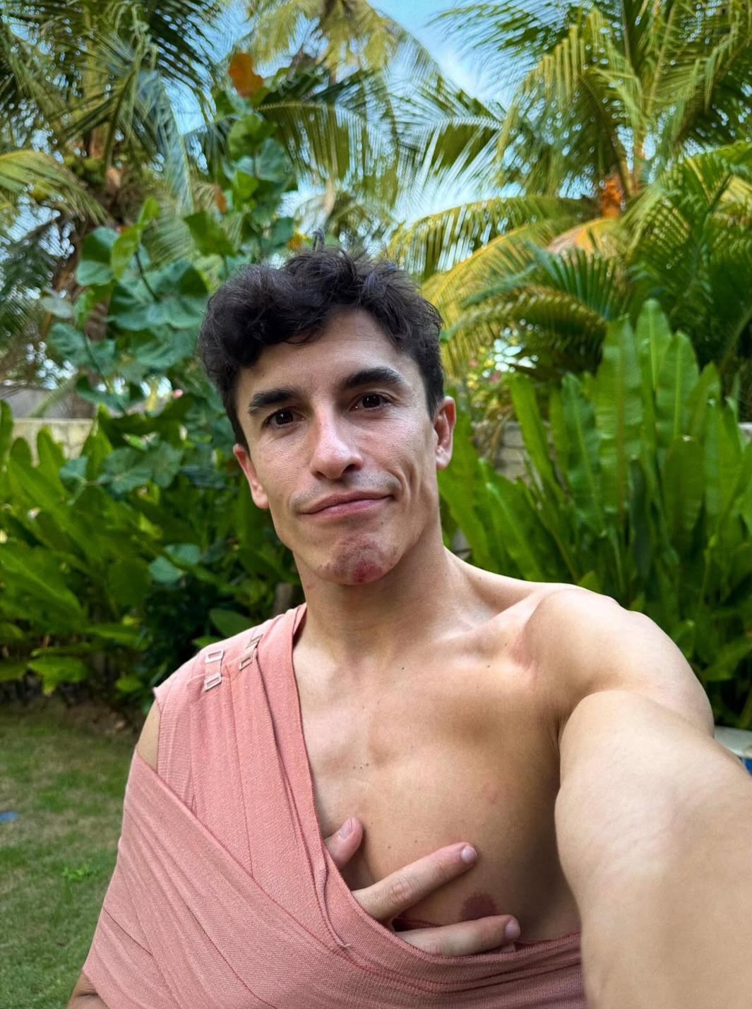 Marc Marquez Absen di MotoGP Australia dan Malaysia, Fokus Pulihkan Cedera Bahu