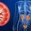 Cuci Darah: Benarkah Bisa Menyembuhkan Gagal Ginjal secara Total?