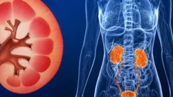 Cuci Darah: Benarkah Bisa Menyembuhkan Gagal Ginjal secara Total?