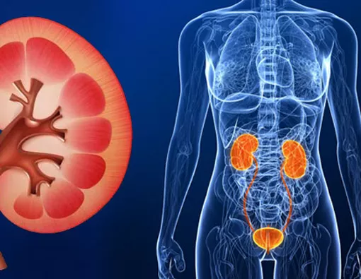 Cuci Darah: Benarkah Bisa Menyembuhkan Gagal Ginjal secara Total?